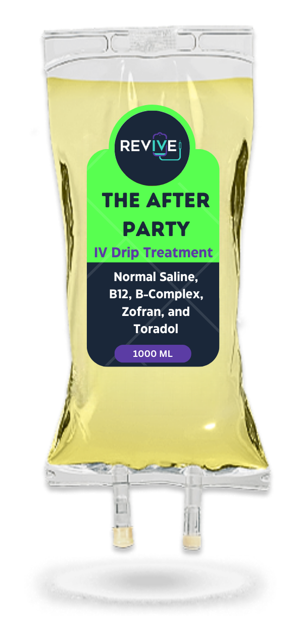The After Party